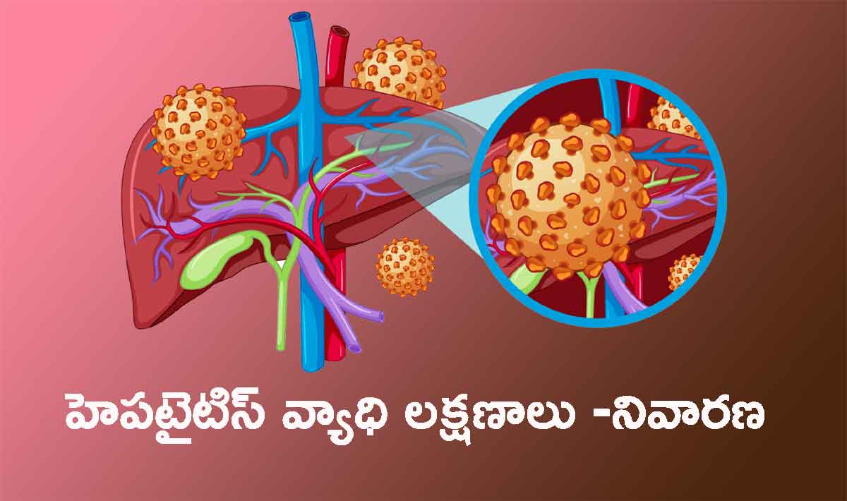 World Hepatitis Day: హెపటైటిస్‌ తో జాగ్రత్త .. లక్షణాలు.. నివారణ